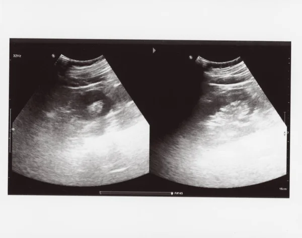 full abdomen ultrasound image aka diagnostic sonogram