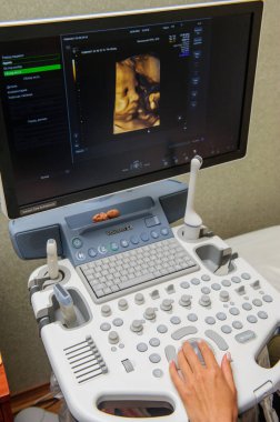 Ultrason makinesi hastane koğuşunda yakınındaki tıp uzmanları.
