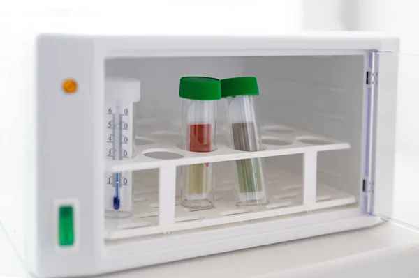 CRP makinesi. Kan deposu. Tıbbi araştırma için laboratuvar materyali.