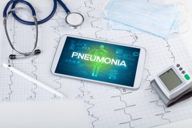 PNEUMONIA yazıtlı tablet pc ve doktor araçları, koronavirüs kavramı