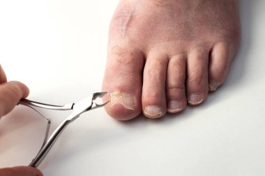 Men's pedicure. A man cuts his toenails.