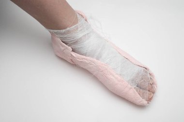 Beyaz arka planda bacağında alçı var..