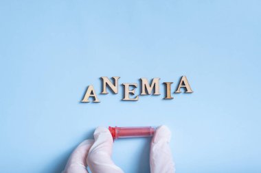 Kan analizi için konteynır içeren amnemia metni. Eldiven düz, üst görünüm.