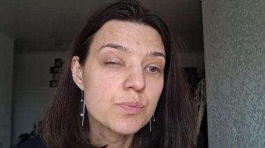 İçeride otururken konjonktivite bağlı şişmiş gözlere bakmak.