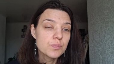 İçeride otururken konjonktivite bağlı şişmiş gözlere bakmak.