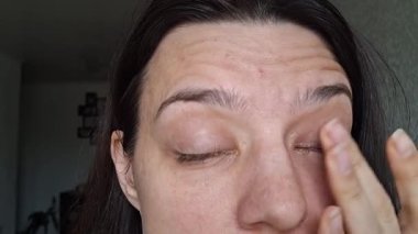 Kadın, evde otururken konjonktivite bağlı şişmiş gözlerle kendine bakar.