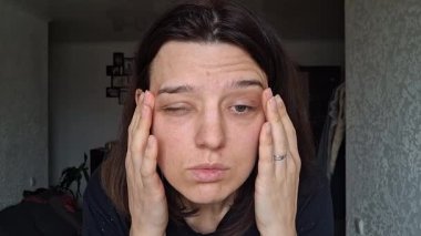 Kadın, evde otururken konjonktivite bağlı şişmiş gözlerle kendine bakar.