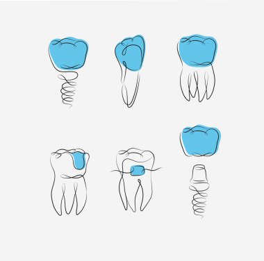 Diş implantı, diş teli, diş kaplaması, diş macunu beyaz ve mavi arka planda doğrusal çizim şeklinde.