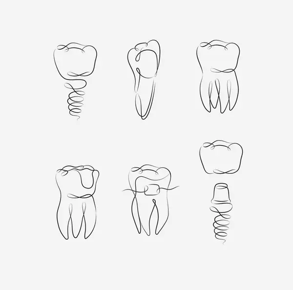 Diş Implantı Diş Teli Diş Kaplaması Beyaz Arka Planda Doğrusal — Stok Vektör