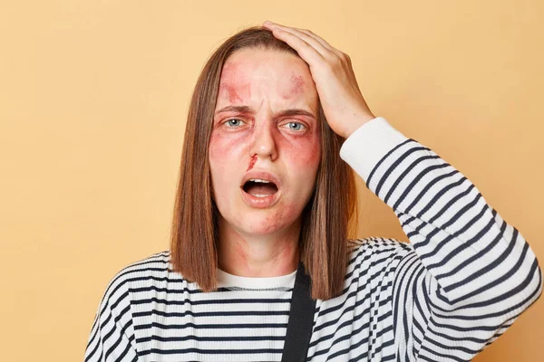 Shocked Despair Disabled Young Girl Scratches Bruises Her Face Wearing — Stock Photo, Image