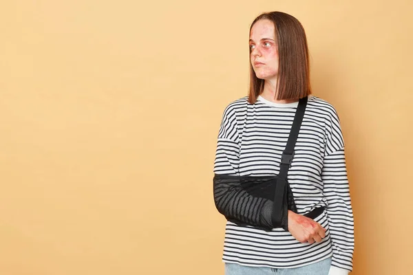 Mulher Deficiente Infeliz Com Hematomas Lesões Vestindo Camisa Listrada Isolado — Fotografia de Stock