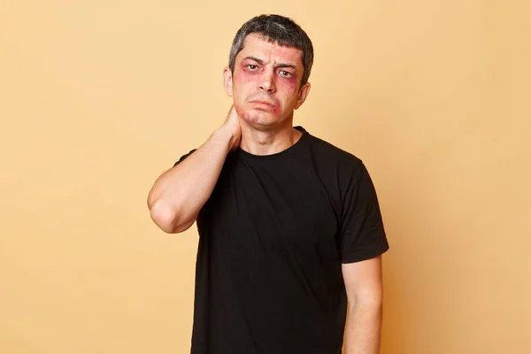 伤心欲绝的男子身穿黑色T恤 脸上有伤痕和擦伤 因米色背景而被隔离 遭受暴力 感到颈部疼痛 — 图库照片