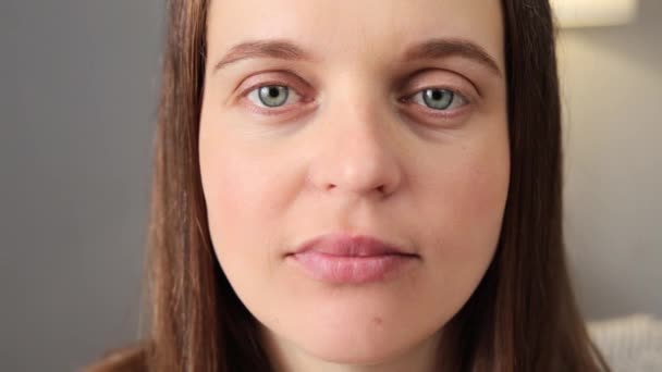 Zbliżenie Brązowe Włosy Kobieta Twarz Uczucie Napięcie Oka Lub Migrena — Wideo stockowe