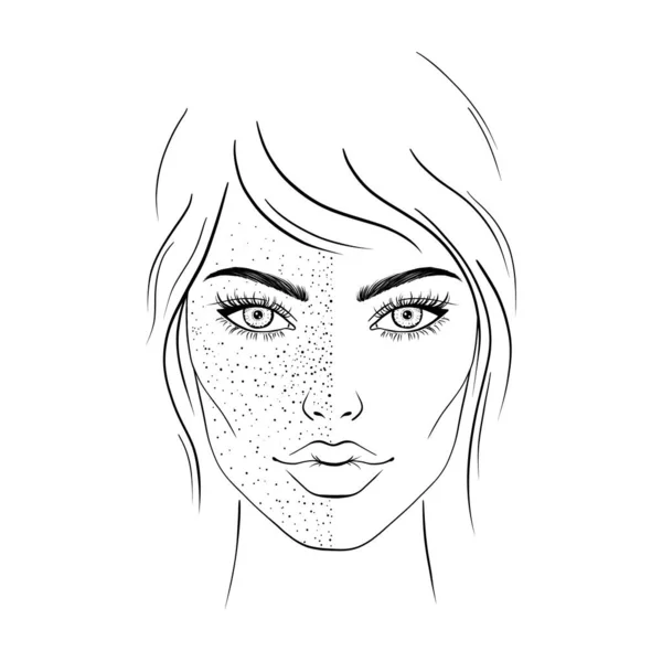 Kvinnligt Ansikte Före Och Efter Tratment Melasma — Stock vektor