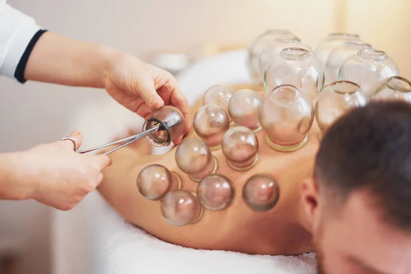 Picture Man Having Cupping Therapy High Quality Photo — Stock Photo, Image