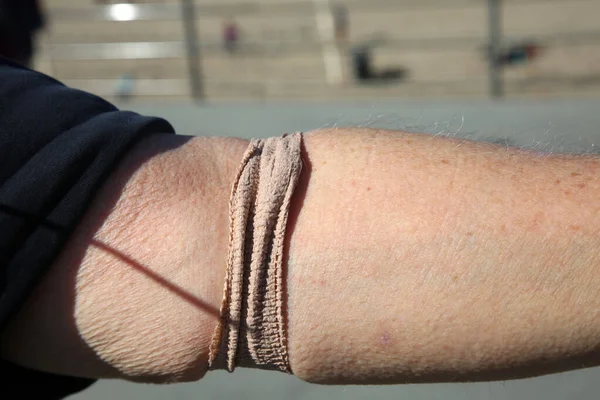 Verband Menschlichen Arm Elastischer Verband Menschlichen Arm Nachdem Einer Arztpraxis — Stockfoto