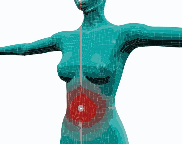 Image Frontale Torse Une Femme Souffrant Douleurs Estomac — Image vectorielle