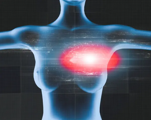Medical Imaging Medical Treatments Concept Analgesics Cardiac Pain Human Body — Stock Photo, Image
