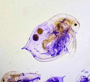 Mikroskop altındaki böcek, mikro dünyanın ürkütücü canavarı.