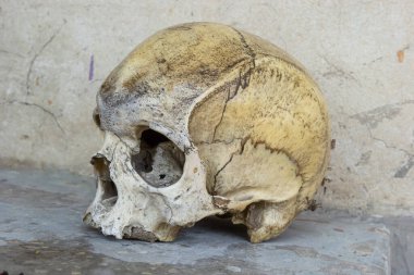 Fosilleşmiş bir insan kafatası, eski özelliklerini ve çatlaklarını sergileyerek taş bir yüzeyde duruyor. Bu eser, arkeolojik bir müzede eğitim amaçlı sergileniyor..