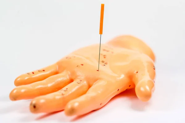 acupuncture needle on hand acupuncture model