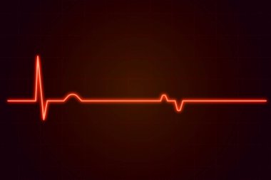 Yoğun bakımda iç aort içi balon pompalama makinesindeki EKG monitörü bulanık arka planda, elektroensefalogramda beyin dalgaları, kalp atış hızı dalgaları