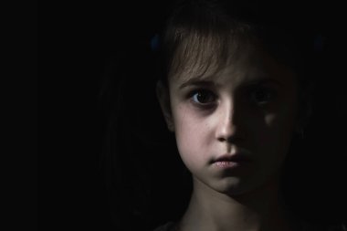 Kavramsal görüntü: psikolojik yaralanmalar, çocukların endişeleri ve korkuları, kayıp çocukluk. Portraqit od sad little child girl feel alone, outcast, children drama. Metin için alanı kopyala.
