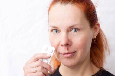 Üst dudağında uçuk olan orta yaşlı bir kadının portresi. Elinde haplar olan bir kadın. HSV yüzünden yüzünde ve dudaklarında enfeksiyon var. Dermatoloji. İlaç..