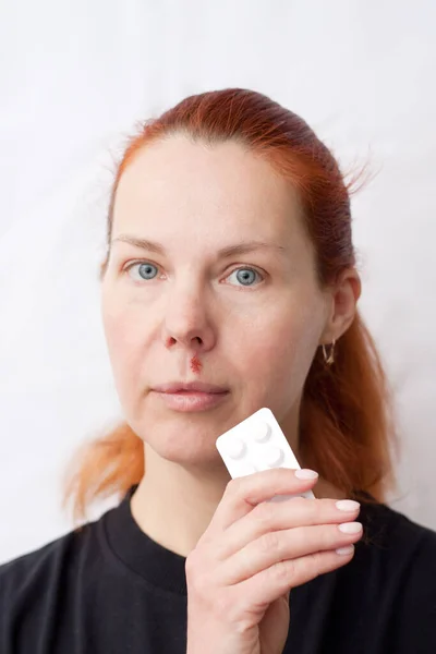 Portrait of middle aged woman with herpes above upper lip, on light background. woman holding pills in hand. Infectious inflammation of face and lips caused by HSV. Dermatology. Medicine.