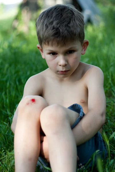 Портрет Дошкільника Який Сидить Траві Свіжим Кровотечею Коліні Дитина Впала — стокове фото