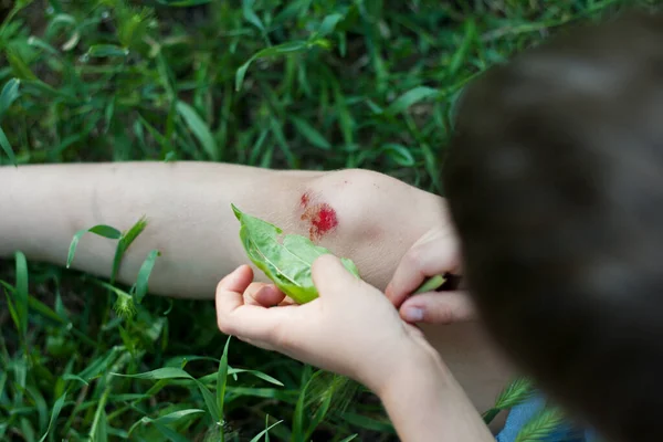 Closeup of fresh bleeding wound on child knee due to fall. child applies plantain leaf to wound. Children injuries in summer outdoors. Phytotherapy, folk medicine.