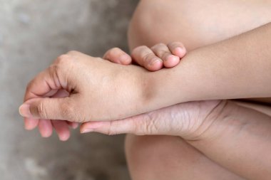 Inflamed muscles with redness in the legs