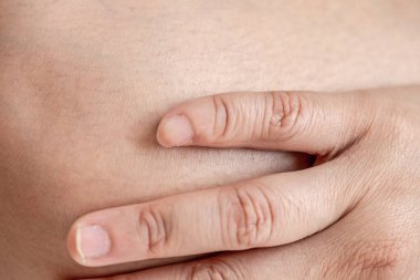 Deformed little finger with surgery