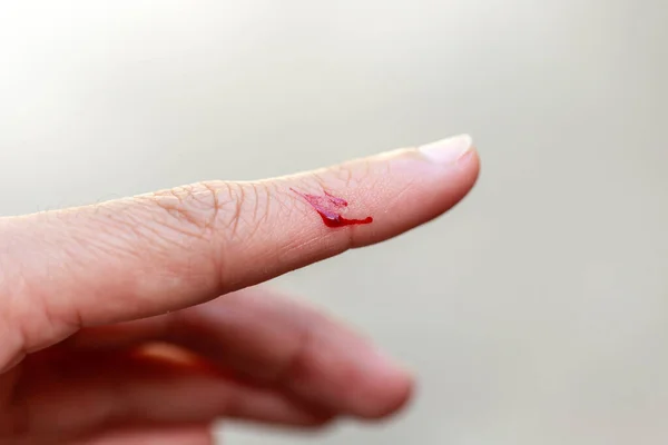 Egy Ujj Amit Megsebesített Egy Kés Vérzett — Stock Fotó