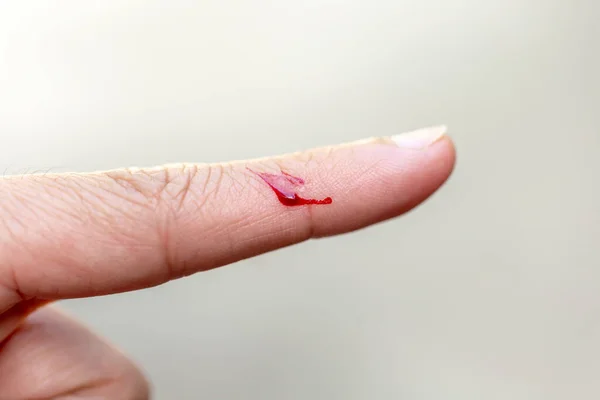 Finger Injured Knife Bleeding — Stock Photo, Image