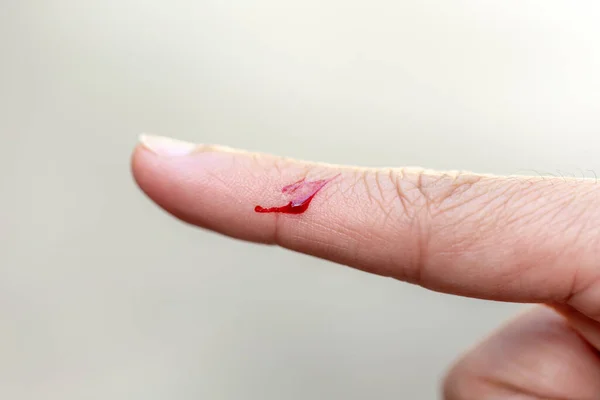 ナイフで負傷し出血していた指 — ストック写真