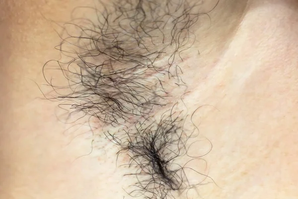 armpit hair is long and unkempt.