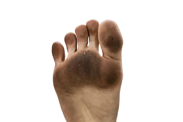 Dirty Smelly Dirty Feet — Stock Photo, Image