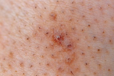 Beyaz tenli, uzamış saçlı, yakın plan.