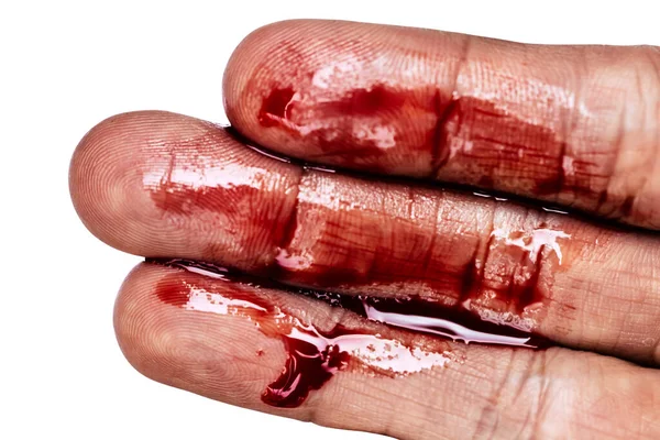 Die Blutflecken Den Händen — Stockfoto