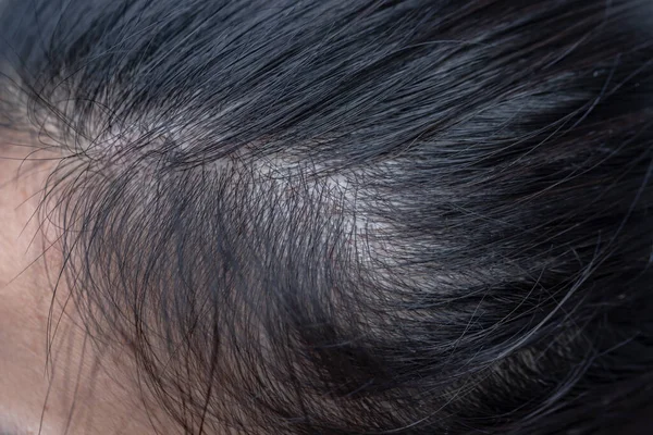 Process Att Färga Håret Med Naturlig Henna — Stockfoto