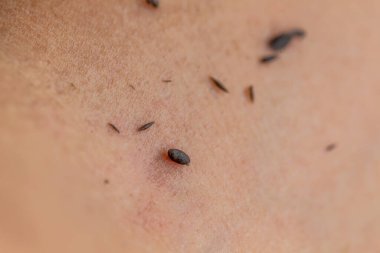 Beyaz tenli siyah bir deri. Cilt bakımı, cilt bakımı