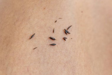 Siyah beyaz insan derisi.