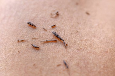 Beyaz arka planda deri ve kuru insan bacakları.