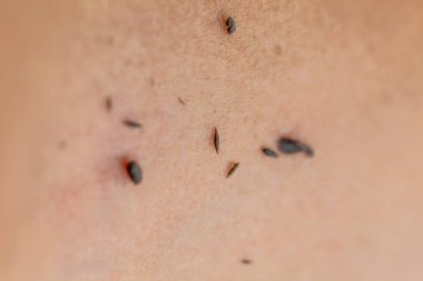 Spa dead skin to remove dirt from the body.