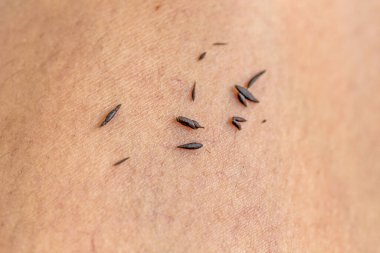 Spa dead skin to remove dirt from the body.