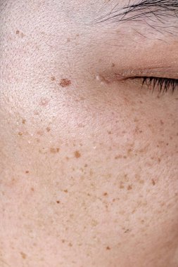 Cildinin damlacıklarıyla genç bir kadın yüzü. Yakından.