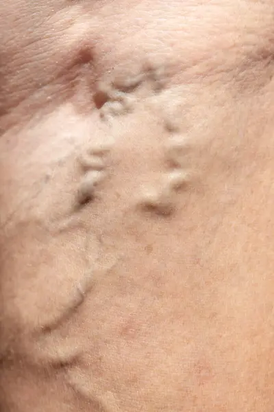 close up view of the skin of a woman with a black skin