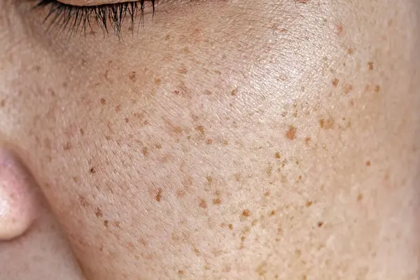 Gözü morarmış bir kadın yüzü..