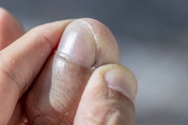 Elinde beyaz bir çivi tutan bir elin yakınına.